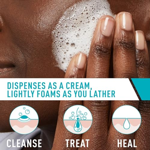 CeraVe - Limpiador en crema espumosa para el acné, lavado facial de peróxido de benzoilo al 4% con ácido hialurónico, niacinamida y ceramidas, tratamiento diario suave para el acné para la cara