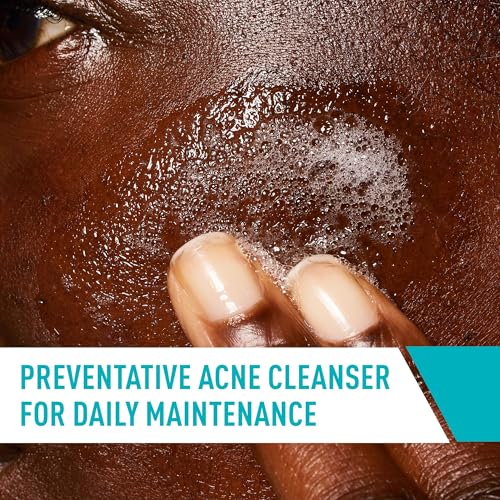 CeraVe - Tratamiento para el acné, limpiador de ácido salicílico con arcilla purificadora, niacinamida y ceramidas, control de poros y removedor de puntos negros, 8 onzas