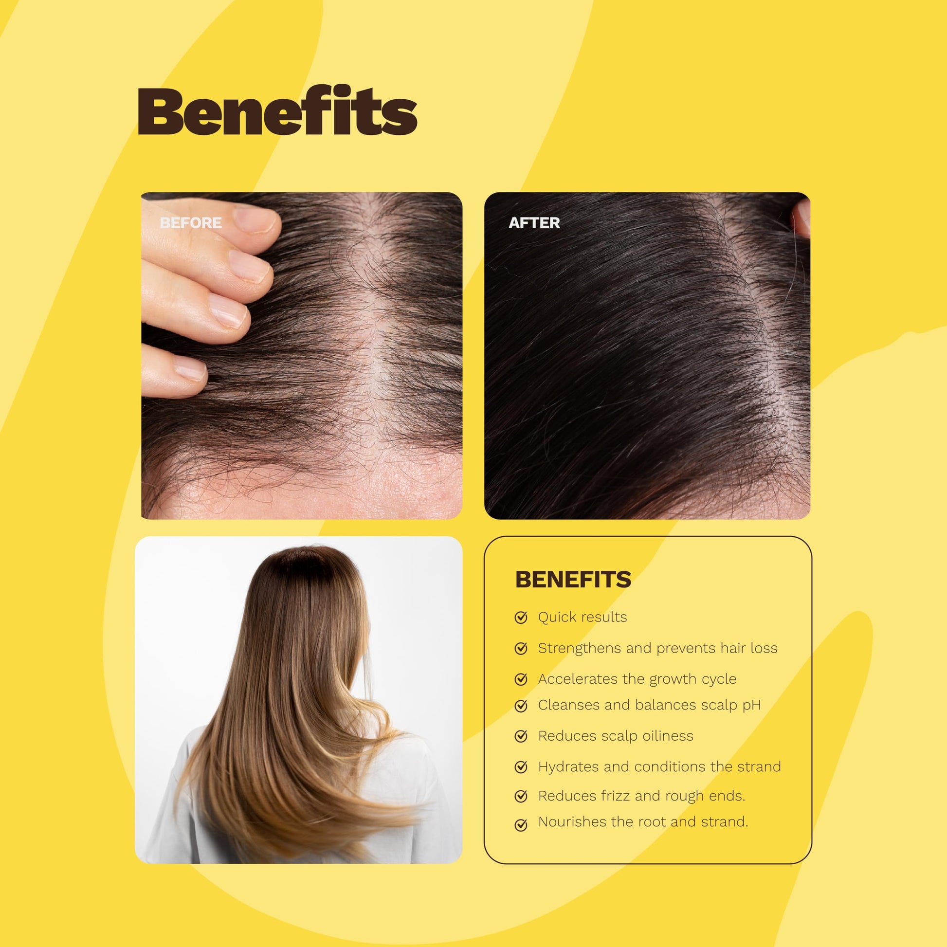 GINGER MILK - SOS Kit de crecimiento del cabello con biotina y jengibre, juego de cuidado del cabello vegano con suero de crecimiento, champú, mascarilla nutritiva y ampolla. Fórmula natural que
