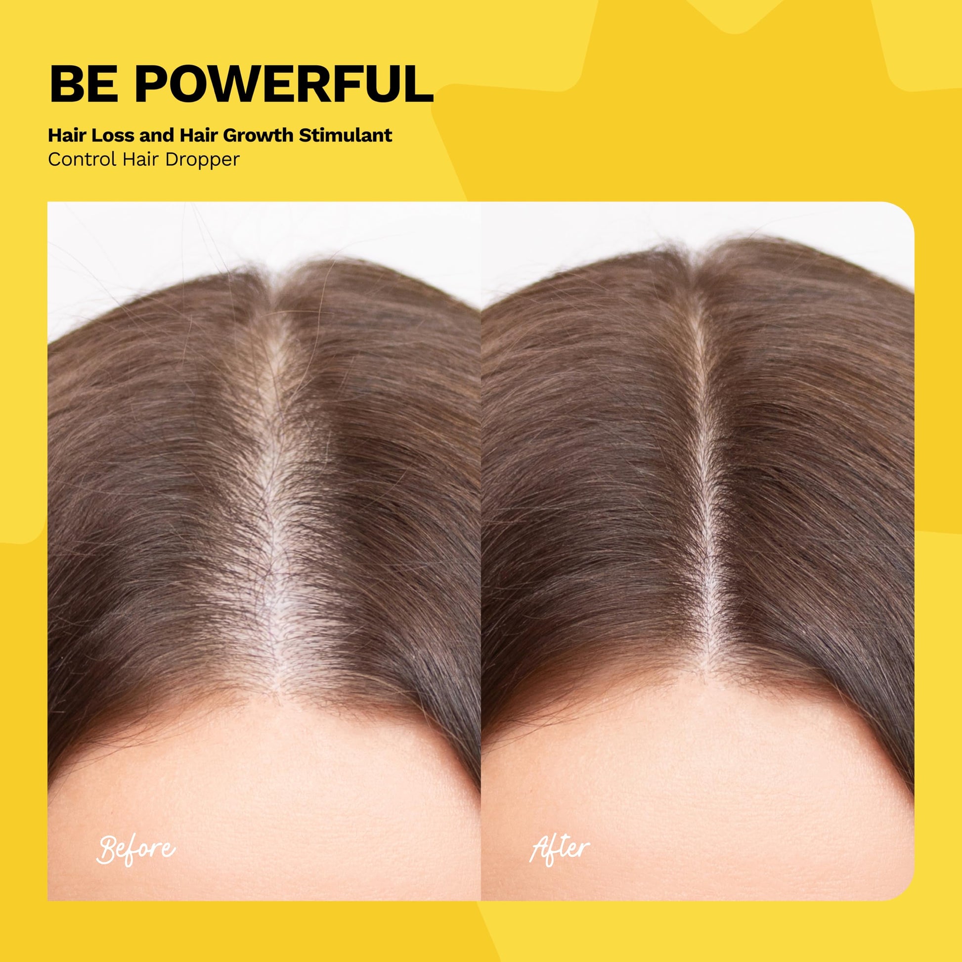 Ginger Milk - Kit de crecimiento del cabello con ingredientes naturales | Suero de 4 fl oz, champú de 16 onzas líquidas y máscara de 16 onzas | Sin parabenos, sal y sulfato