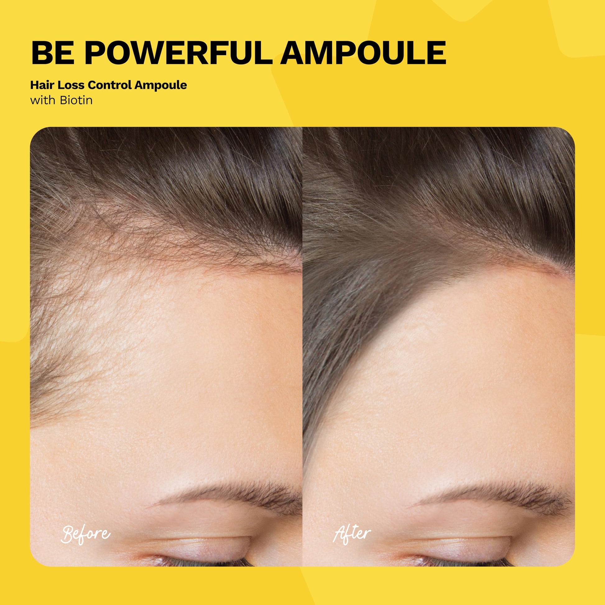 Ginger Milk - Ampolla para el crecimiento del cabello con biotina y jengibre, controla la pérdida de cabello, estimula el cuero cabelludo y fortalece las raíces, sé poderoso con leche de jengibre, paquete de 3 (0.5